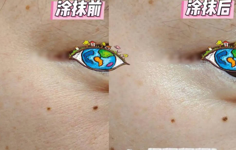 干敏肌用什么面霜