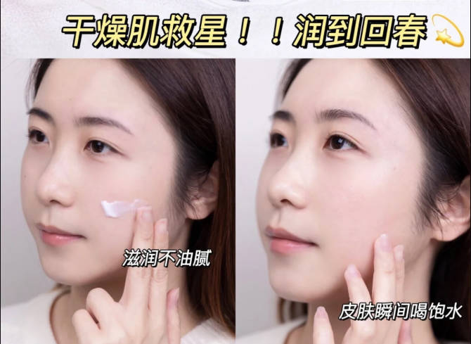 干皮敏感肌补水面霜推荐