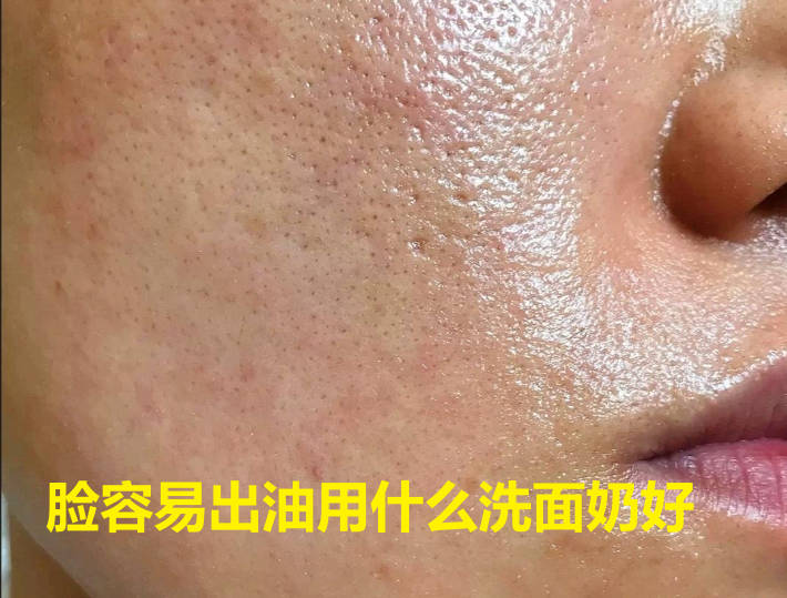 脸容易出油用什么洗面奶好