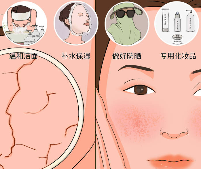 敏感肌夏天怎么护肤