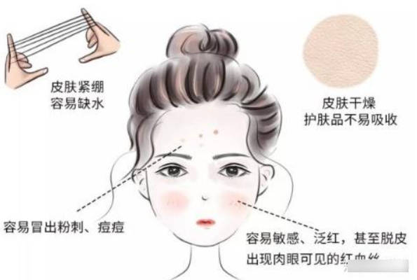 敏感肌用什么面霜好