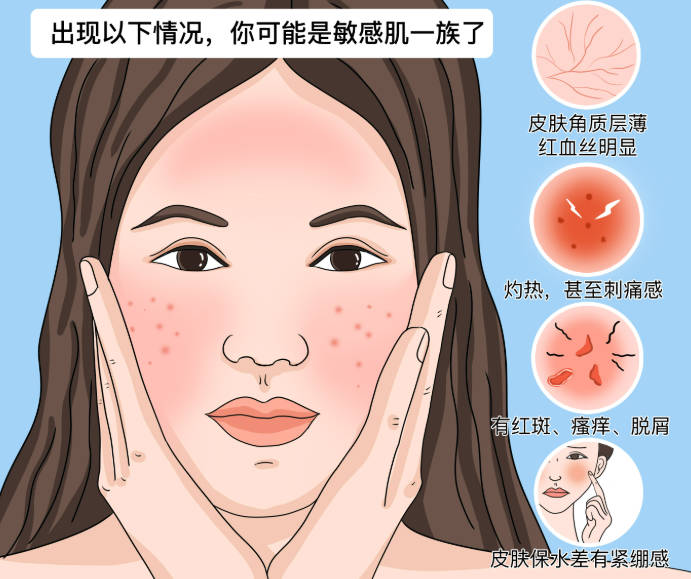 敏感肌怎么调节