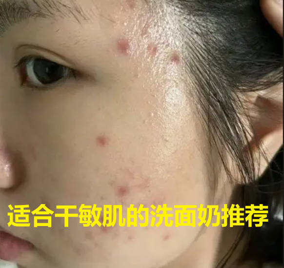 适合干敏肌的洗面奶推荐