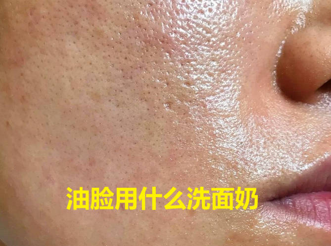油脸用什么洗面奶