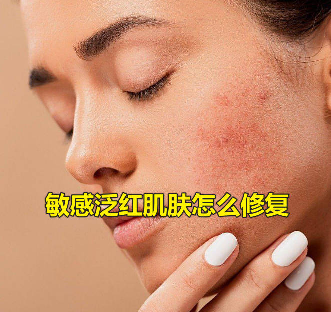 敏感泛红肌肤怎么修复