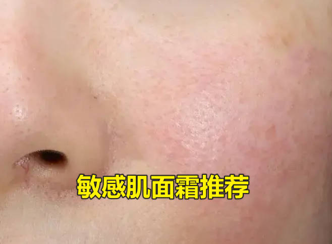敏感肌面霜