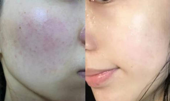 敏感肌用什么保湿霜好