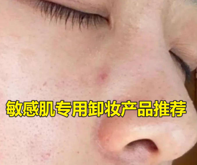 敏感肌专用卸妆产品