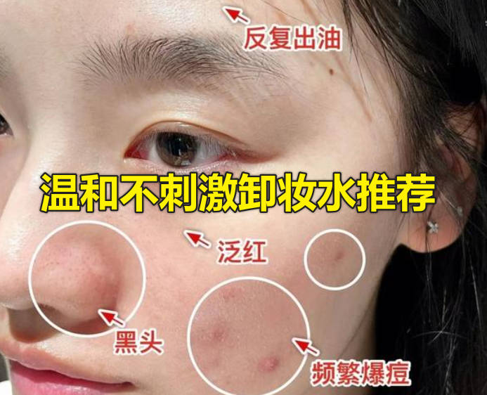 温和不刺激卸妆水推荐