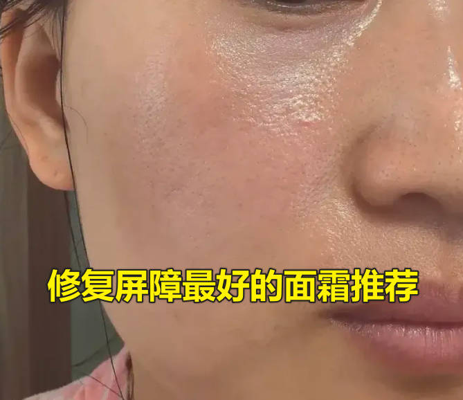 修复屏障最好的面霜