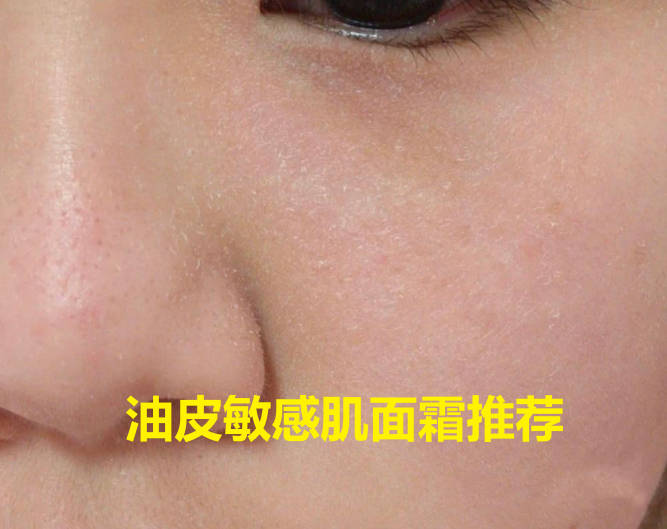 油皮敏感肌面霜