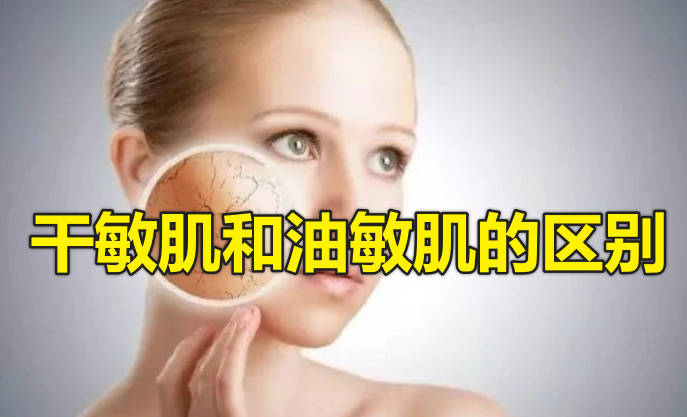 干敏肌和油敏肌的区别