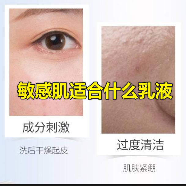 敏感肌适合什么乳液