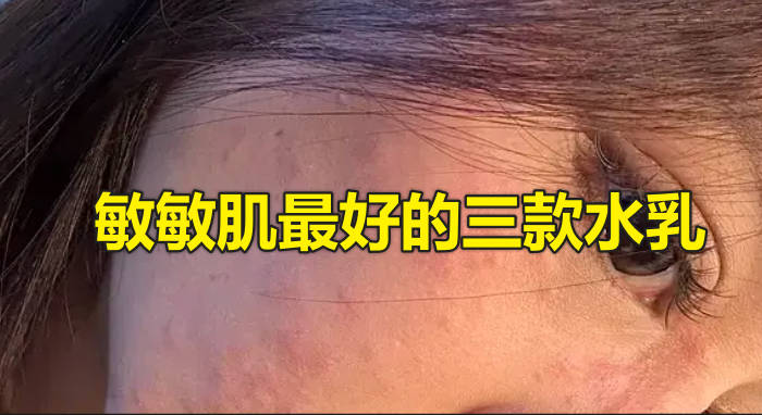 敏敏肌最好的三款水乳