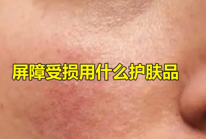 屏障受损用什么护肤品