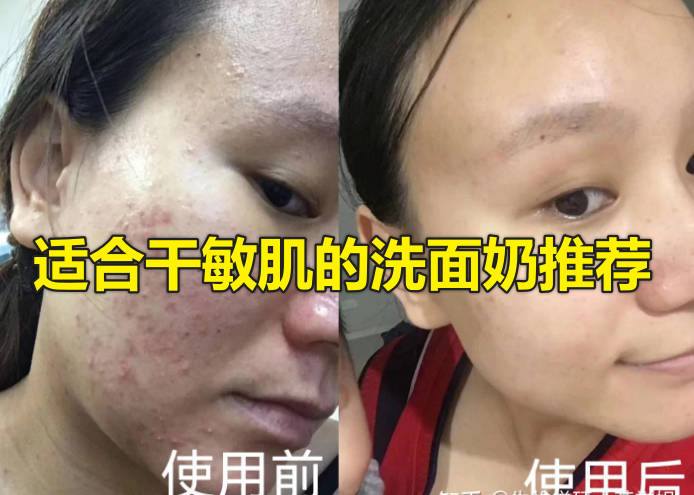 适合干敏肌的洗面奶推荐