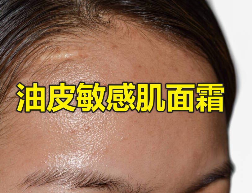 油皮敏感肌面霜