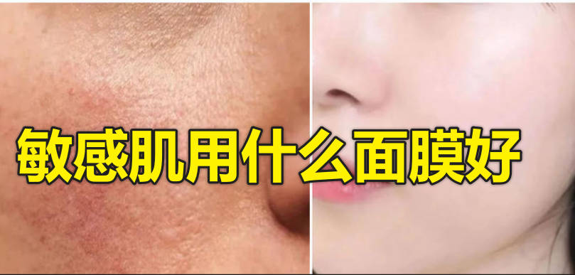 敏感肌用什么面膜好